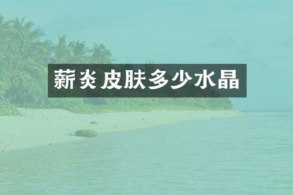 薪炎皮肤多少水晶