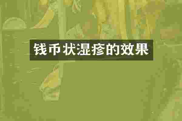 钱币状湿疹的效果